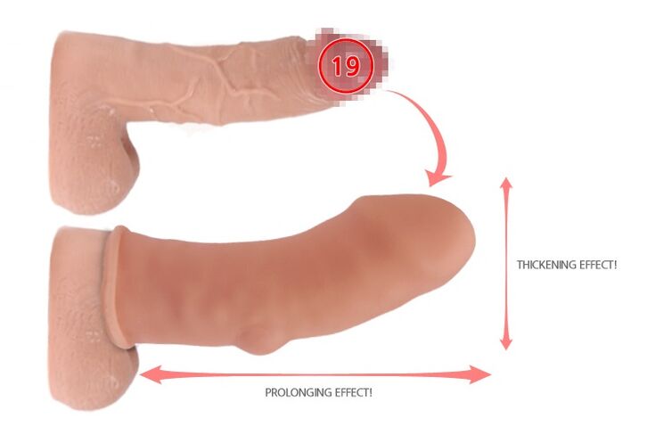 ingrandimento del pene con ugello